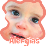 Alergias e dermatites, como ajudar seu filho a acabar com esses desconfortos