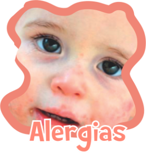 Alergias e dermatites, como ajudar seu filho a acabar com esses desconfortos